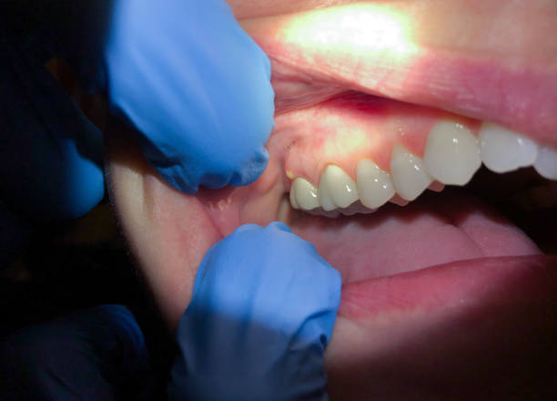 Best Emergency Cosmetic Dentistry in Oakes, ND