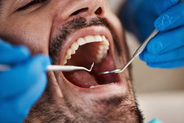 Best Urgent Dental Care for Toothache in Oakes, ND