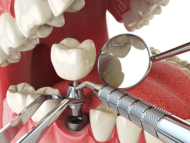 Best Pediatric Emergency Dentist in Oakes, ND